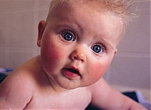 Почему у малыша стали щечки розовенькими или что такое детский диатез?